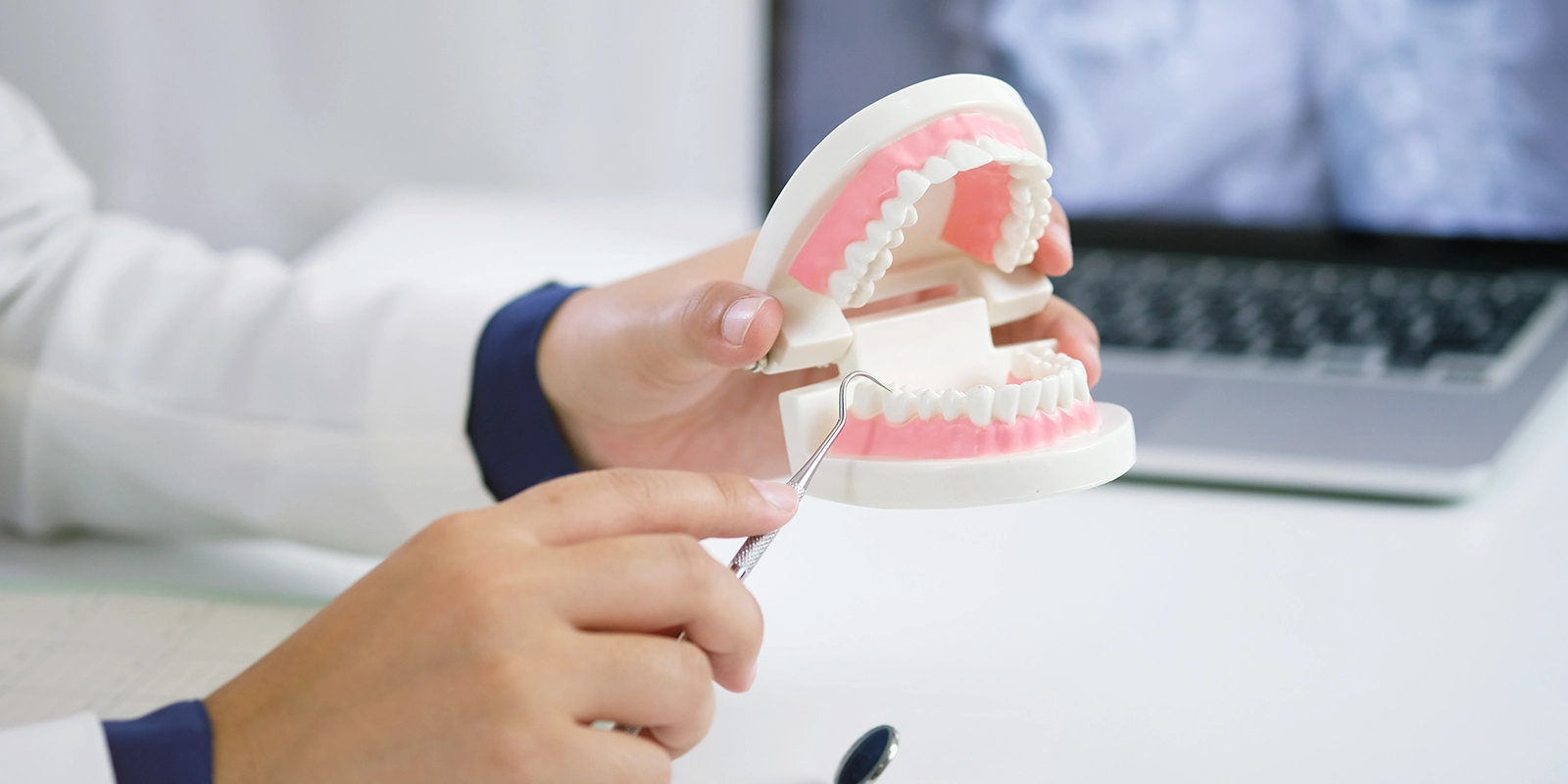 食いしばり・歯ぎしりへのボトックス治療