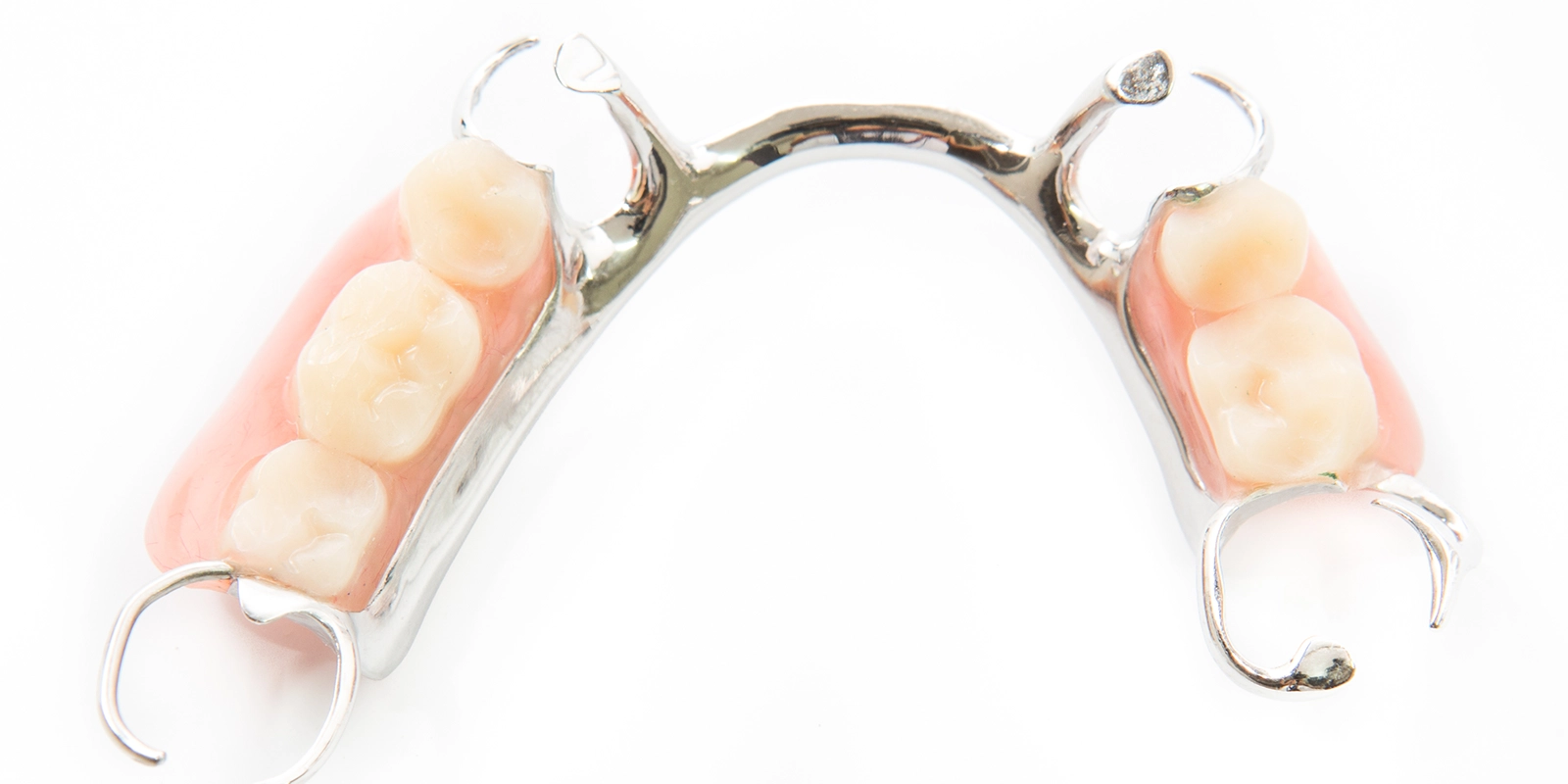 部分入れ歯のイメージ