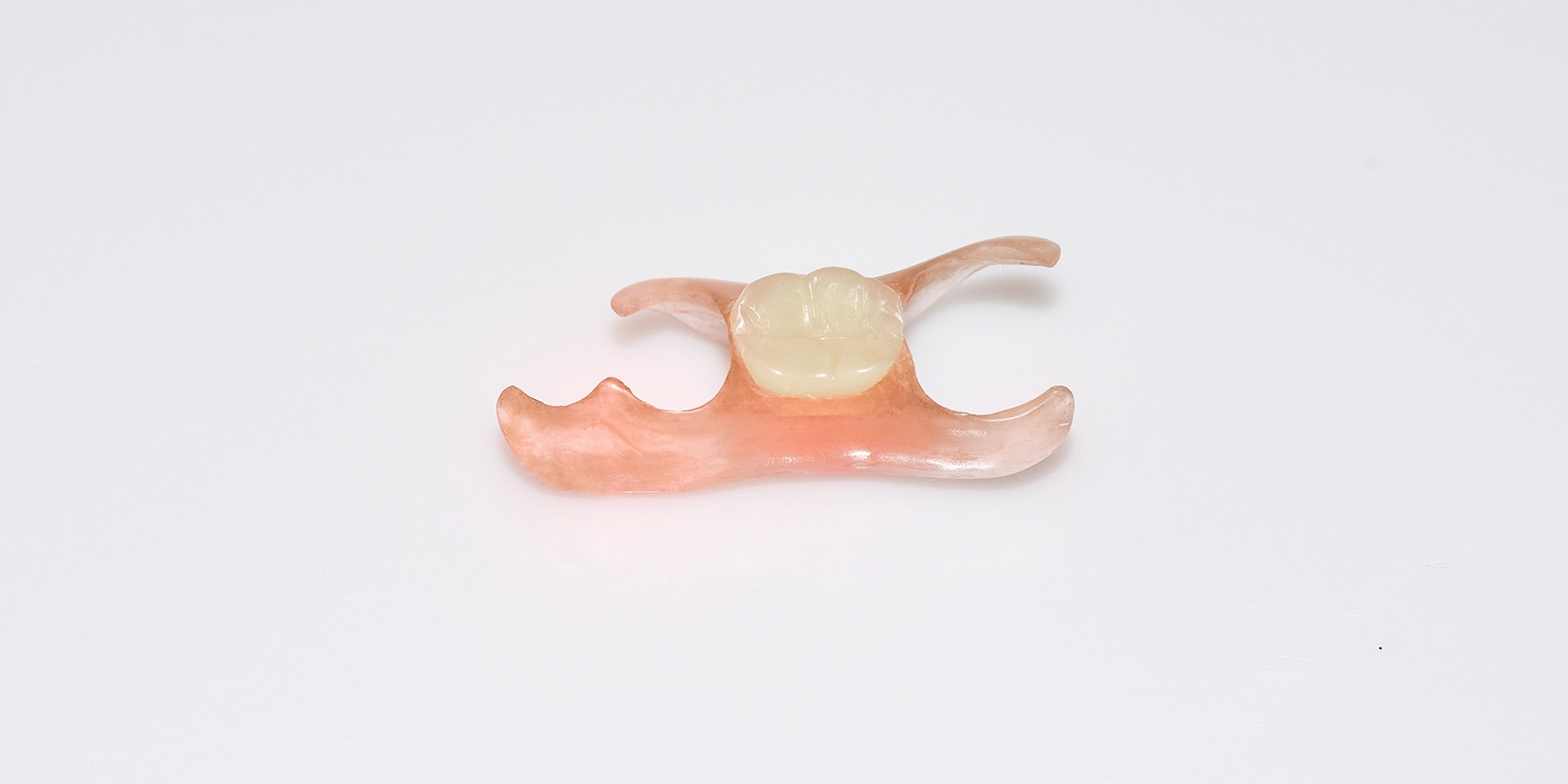 ノンクラスプデンチャーのイメージ