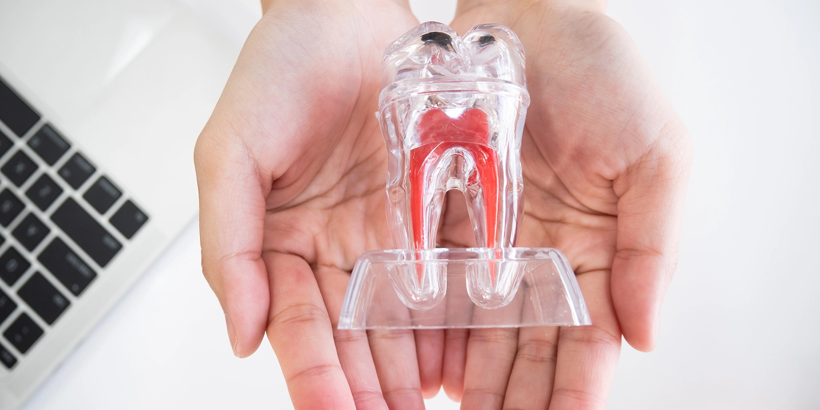 精密な根管治療のイメージ