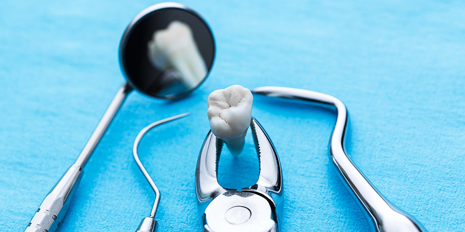 親知らずの抜歯について